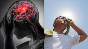 हीट स्ट्रोक और डिहाइड्रेशन से बचाव के आसान उपाय देश के अलग-अलग हिस्सों में वर्तमान में भीषण गर्मी पड़ रही है। गर्मी के मौसम में हीट स्ट्रोक और डिहाइड्रेशन का खतरा बहुत अधिक बढ़ जाता है। यदि समय रहते ये समस्याएं संभाली न जाएं तो जानलेवा भी हो सकती हैं। बताया जाता है कि हीट स्ट्रोक तब होता है जब शरीर का तापमान बहुत ज्यादा बढ़ जाता है और पसीना आना बंद हो जाता है, जिससे शरीर खुद को ठंडा नहीं रख पाता। हीट स्ट्रोक के लक्षणों में तेज सिरदर्द, चक्कर आना, उल्टी, कमजोरी और बेहोशी आदि की समस्या हो सकती है। वहीं, डिहाइड्रेशन (शरीर में पानी की कमी) भी गर्मी में आम समस्या है, जिससे थकान, कमजोरी और चक्कर आने जैसी दिक्कतें हो सकती हैं। गर्मी के मौसम में इनसे बचाव के लिए शरीर को हाइड्रेटेड रखना बहुत जरूरी है। प्रतिदिन कम से कम तीन से चार लीटर पानी जरूर पिएं। इसके अलावा नारियल पानी, नींबू पानी, छाछ और ताजे फलों जैसे- जामुन, तरबूज, खीरा, पपीता आदि का सेवन करें। इनमें पानी की मात्रा ज्यादा होती है। इनका सेवन शरीर को ठंडक प्रदान करता है। यदि जरूरी न हो तो दोपहर के समय घर से बाहर निकलने से बचें। इसके साथ ही हल्के, सूती और ढीले कपड़े पहनें। वहीं, घर से बाहर निकलते समय सनस्क्रीन का इस्तेमाल जरूर करें और ज्यादा शारीरिक मेहनत करने से बचें। बाहर से लौटकर तुरंत ठंडा पानी पीने से बचें, पहले शरीर को सामान्य तापमान पर आने दें, इसके बाद ही पानी पिएं। इसके अलावा खाली पेट घर से बाहर न निकलें और तला-भुना, मसालेदार खाने से बचें। बाहर का तला-भुना और ज्यादा मसालेदार खाने से शरीर की गर्मी बढ़ सकती है। इसलिए घर का हल्का, सुपाच्य और ठंडी तासीर वाला भोजन करें। साथ ही, मीठे और मादक पेय पदार्थों से बचें, क्योंकि ये शरीर को डिहाइड्रेट कर सकते हैं। यदि हीट स्ट्रोक के लक्षण महसूस हों तो तुरंत छायादार जगह पर जाकर ठंडे पानी से शरीर को ठंडा करें और तुरंत डॉक्टर से संपर्क करें। पर्याप्त नींद लेना बेहद जरूरी है ताकि शरीर तरोताजा रहे और गर्मी से लड़ने की क्षमता बनी रहे। इन आसान उपायों को अपनाकर आप गर्मी के मौसम में खुद को सुरक्षित और स्वस्थ रख सकते हैं।